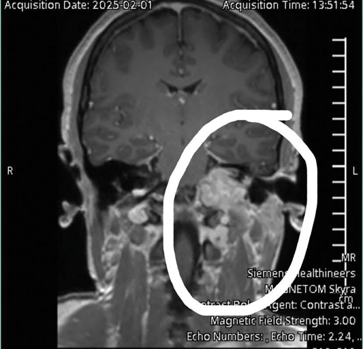 Oya-Rhodes-survivor-story_brain-tumor-scan - Gulf Coast Woman Magazine
